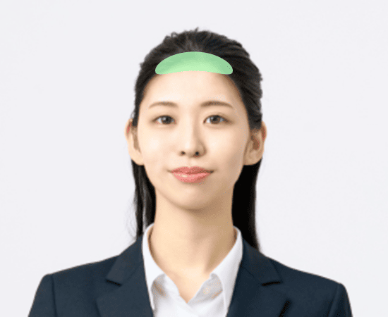 髪の前 生際 中央