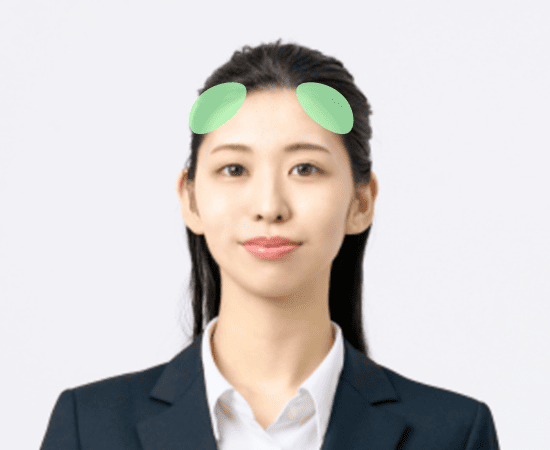 髪の生え際 両方